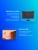 Монитор LG 24.5" 25MS500-B черный IPS LED 16:9 HDMI матовая 1000:1 250cd 178гр/178гр 1920x1080 100Hz FHD 2.6кг - купить недорого с доставкой в интернет-магазине